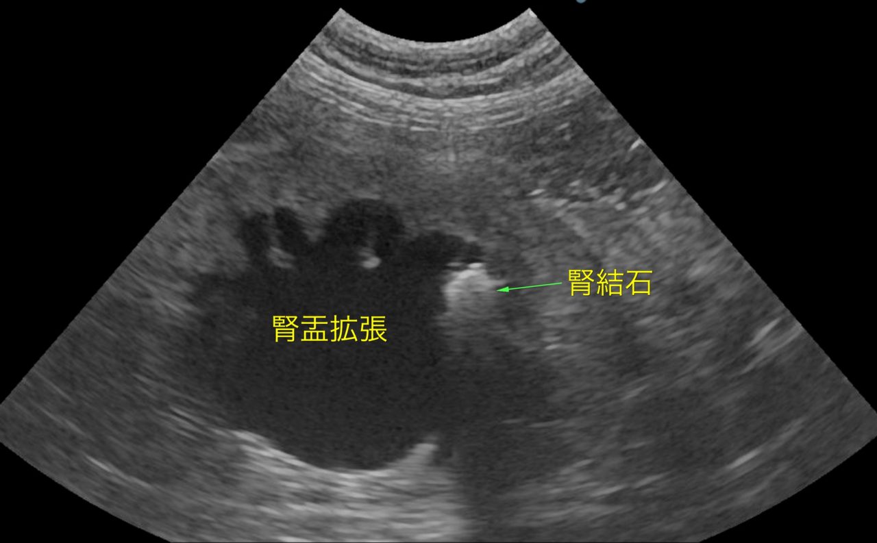 猫の左右尿管結石による腎機能障害｜東京都町田市の二次診療動物病院 