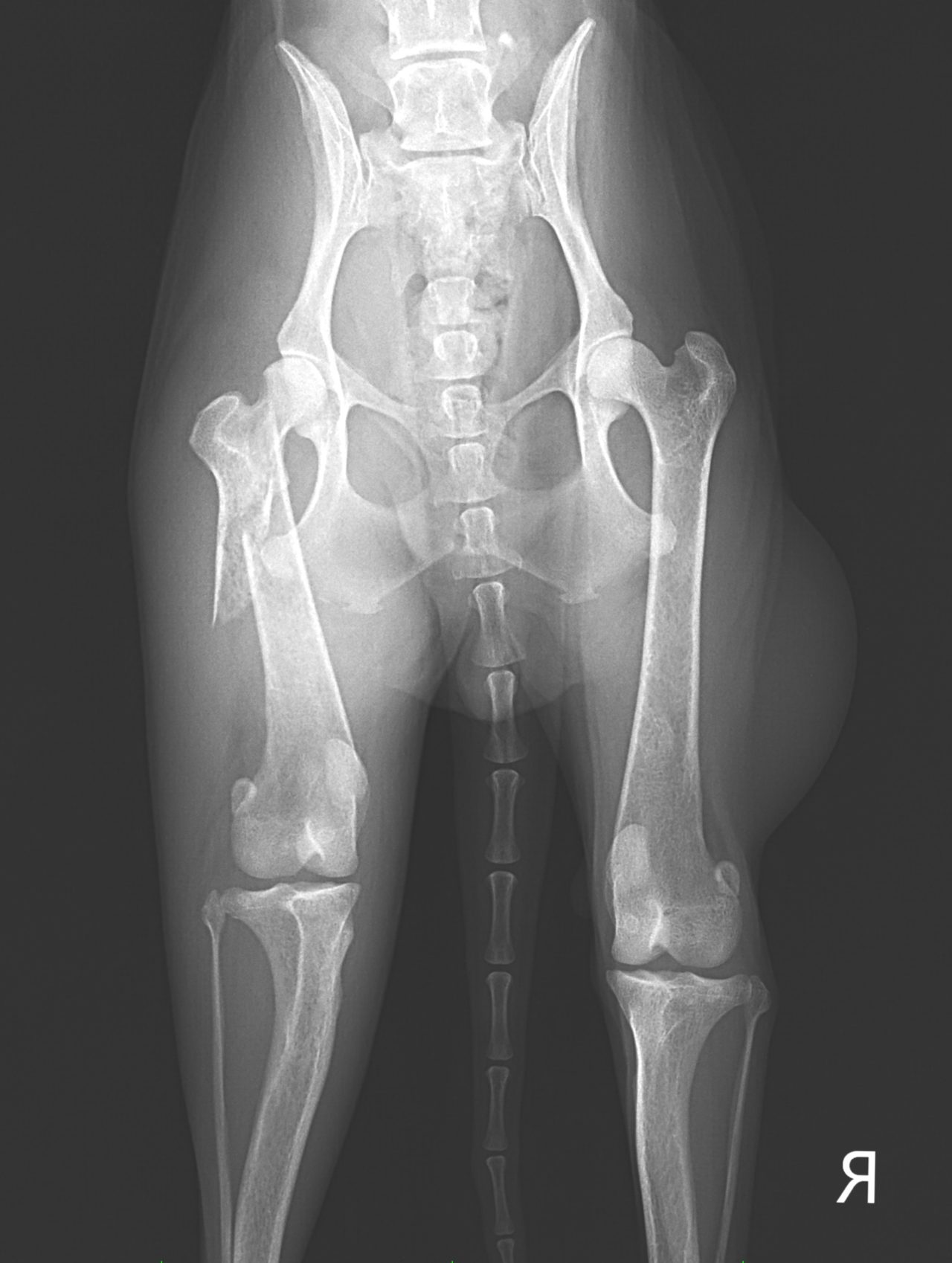 大腿骨転子部骨折の評価から治療 | 理学療法要点ドン！